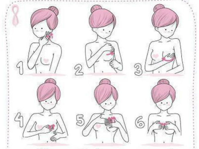 cáncer de mama en Farmacia Ciudad Jardín en Málaga